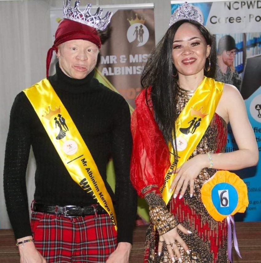 winners MR & MRs Albinism